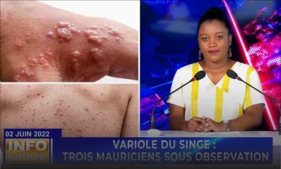 INFO SOIREE :  « Enn dokter inn dir mwa variole du singe, enn lot dir bizin atan rezilta »