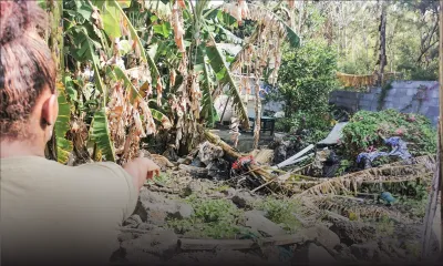 Hospitalisé à la Burns Unit : Kyliam, 3 ans, grièvement brûlé au visage