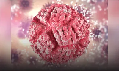 Cancer : hausse des admissions  de 13,7 % en 2023