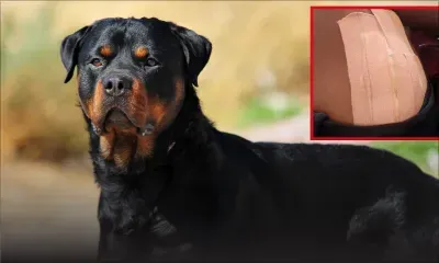 Barkly : un Rottweiler attaque une femme en pleine rue