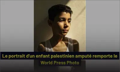Le portrait d'un enfant palestinien amputé remporte le World Press Photo
