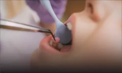 Les maladies bucco-dentaires touchent près de la moitié de la population mondiale