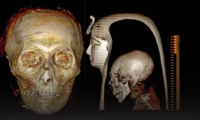 Les secrets d'une momie dévoilés... sans la dénuder d'une bandelette