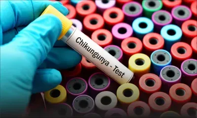 Chikungunya : 26 cas actifs recensés à Maurice