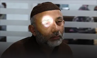 Pakistan : fermeture momentanée de 56 000 écoles pour contrôler une épidémie de conjonctivite