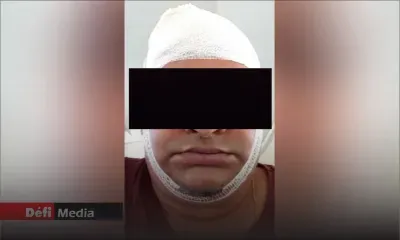 Agression à Vacoas lié à un conflit autour d’un passage commun : un sexagénaire lance des pots de fleurs sur la tête d’un père de famille