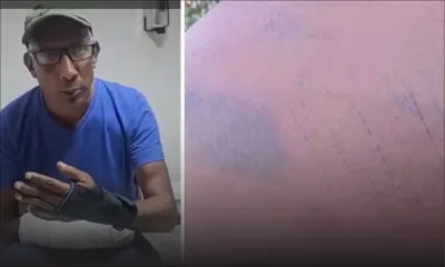 Bois d’Oiseaux – Sauvagement agressé, il remet une vidéo accablante à la police, mais attend toujours justice