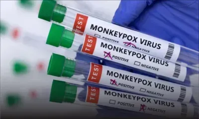 Variole du singe: l'OMS déclenche son plus haut niveau d'alerte