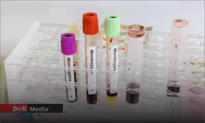 Variole du singe: face à la hausse des cas, l'UE s'assure 54.000 vaccins de plus