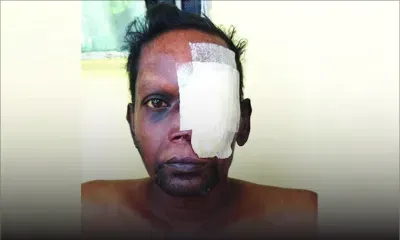 Souffrant d’un cancer du nez, Vele Ramen a besoin d’aide