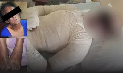 Médine Camp-de-Masque : Il allègue avoir été aspergé d’alcool et brûlé par sa mère 