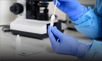 Covid-19 : le ministère de la Santé surveille de près le nouveau sous-variant d’Omicron EG.5