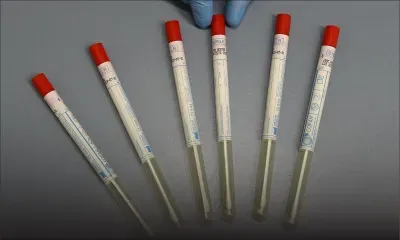 Virus: l'Allemagne autorise des mesures de confinement renforcées face au risque de 2e vague