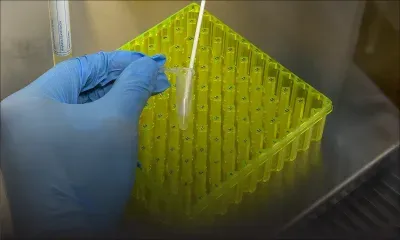 Covid-19: le projet de vaccin d'Oxford offrirait une double protection 