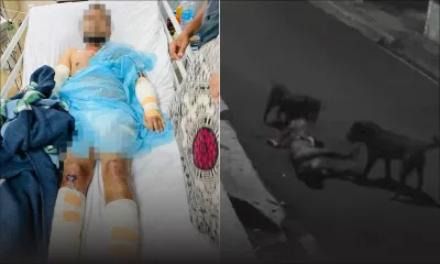 Attaqué par deux Rottweilers, Vijay Ragoo toujours aux soins intensifs de l’hôpital Jeetoo