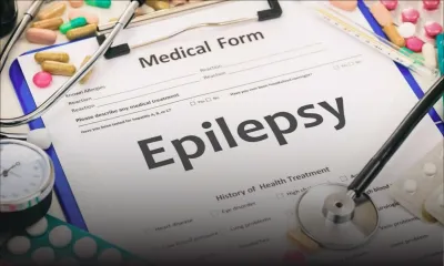 Journée internationale : entre 25 000 et 30 000 épileptiques à Maurice