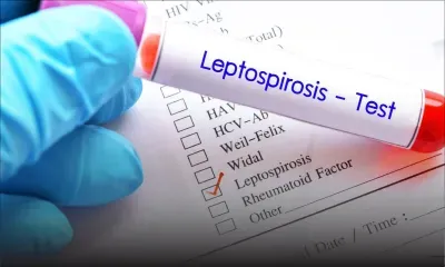 41 cas de leptospirose enregistrés en cinq mois