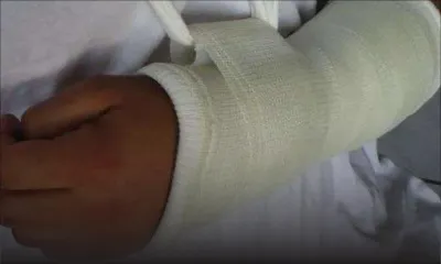 À Port-Louis : un homme de 28 ans attaqué par un molosse en pleine rue