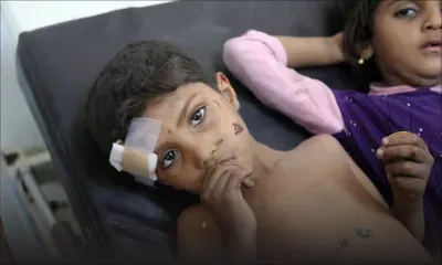 Yémen: des raids aériens saoudiens font au moins 20 morts dans un mariage 