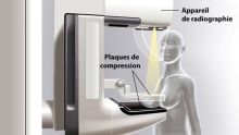Appareil de mammographie en panne : une centaine de patientes dans l’incertitude