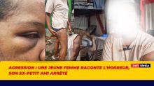 Agression : une jeune femme raconte l'horreur, son ex-petit ami arrêté