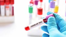 COVID-19 : baisse du nombre de nouveaux cas malgré la présence du sous-variant BF.7 