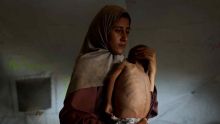 Un enfant sur cinq dans la ville de Gaza souffre de malnutrition, selon une agence de l’ONU 
