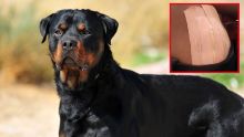 Barkly : un Rottweiler attaque une femme en pleine rue