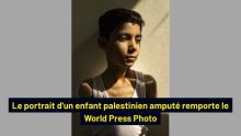 Le portrait d'un enfant palestinien amputé remporte le World Press Photo