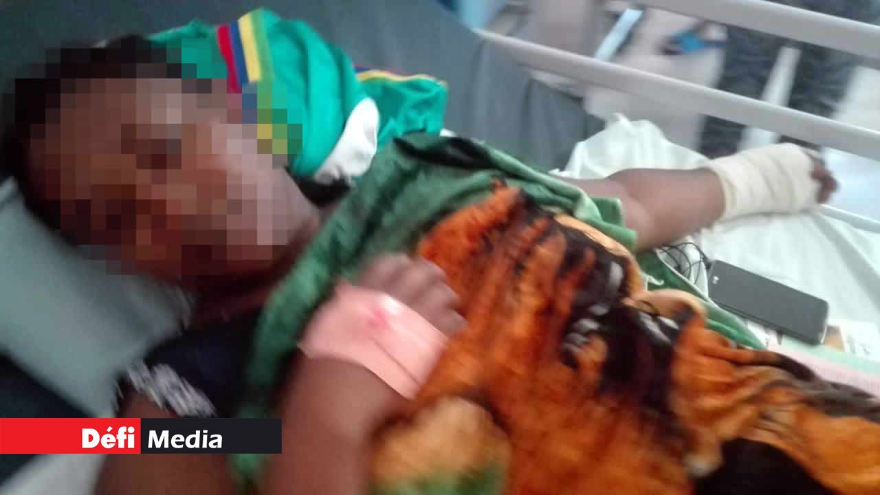 La victime est encore sous le choc.