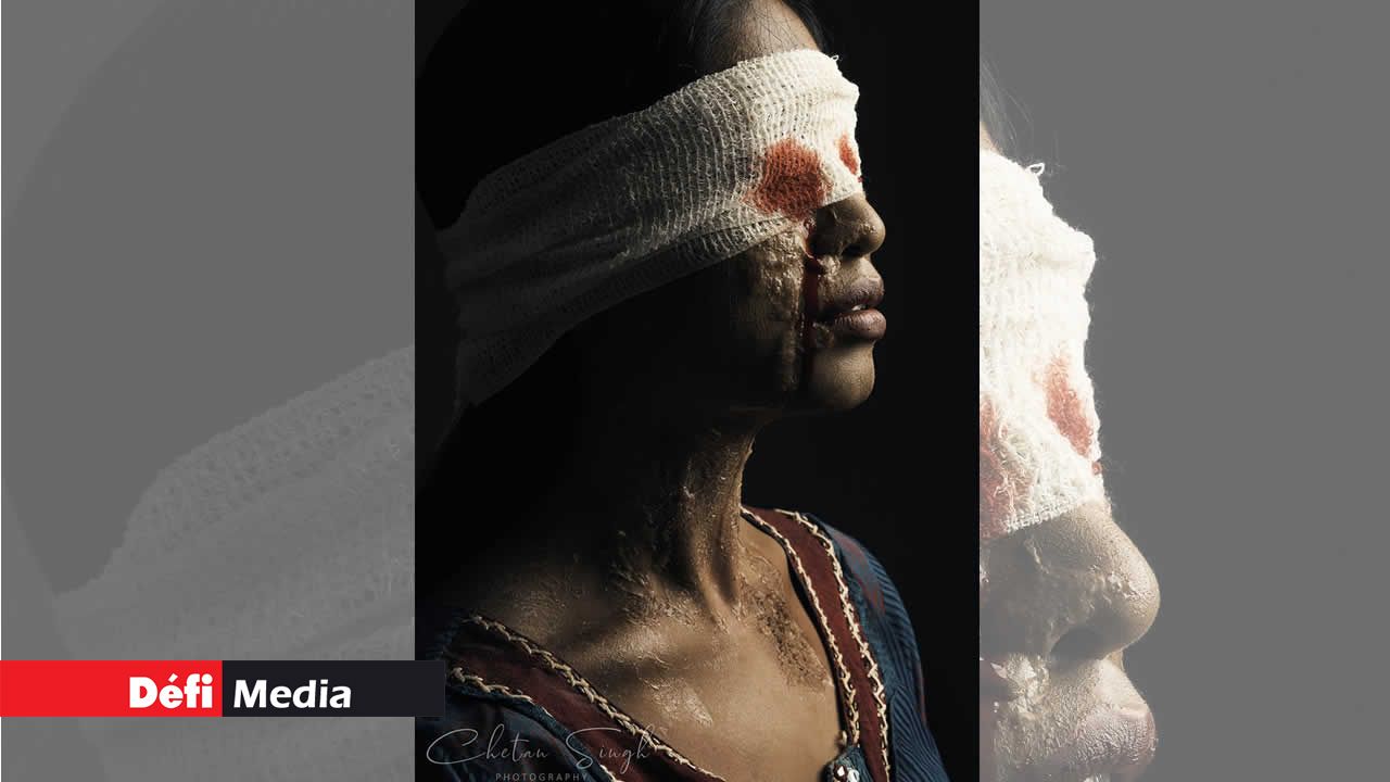 On lui avait interdit de se regarder dans le miroir avant qu’elle ne soit rétablie. On lui a dit de se préparer à accepter son nouveau visage. Elle a commencé à verser des larmes de sang. « Chhapaak » : éclaboussure. Chhapaak