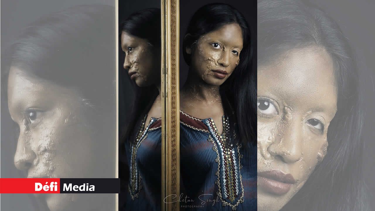 Mais elle a accepté son sort. Elle a lutté contre la violence à l’acide et elle est devenue une inspiration pour le monde. Chhapaak