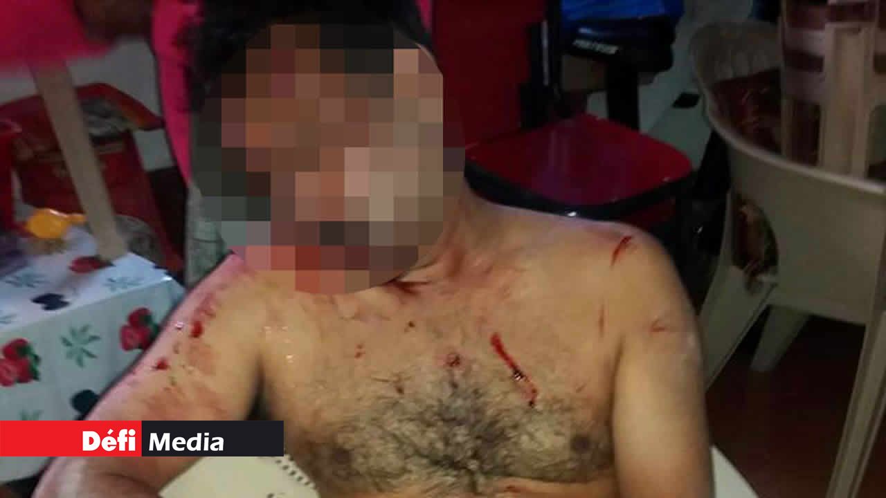 Kanaven, la victime.