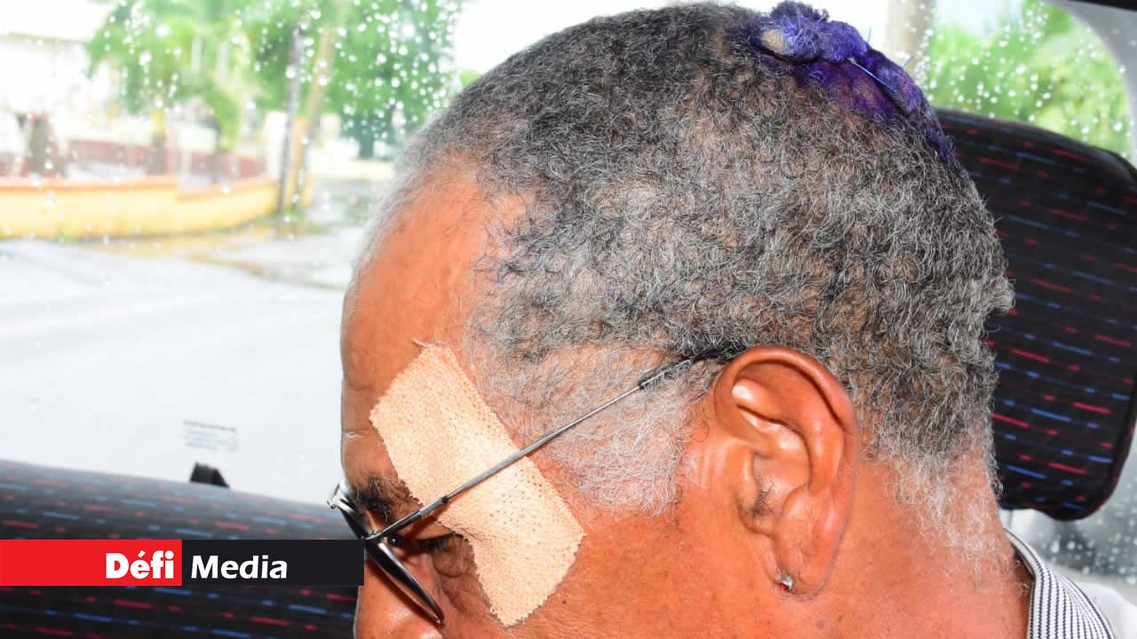 Le maçon a reçu de violents coups à la tête et au visage.