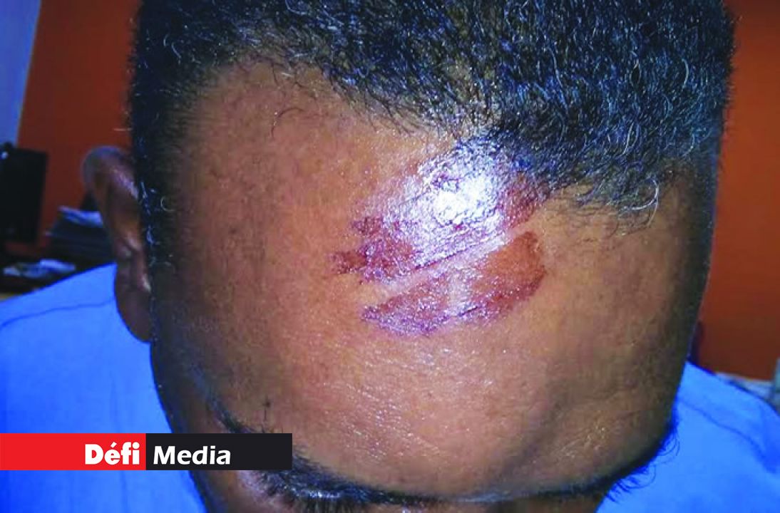 Le voisin protestataire agressé.