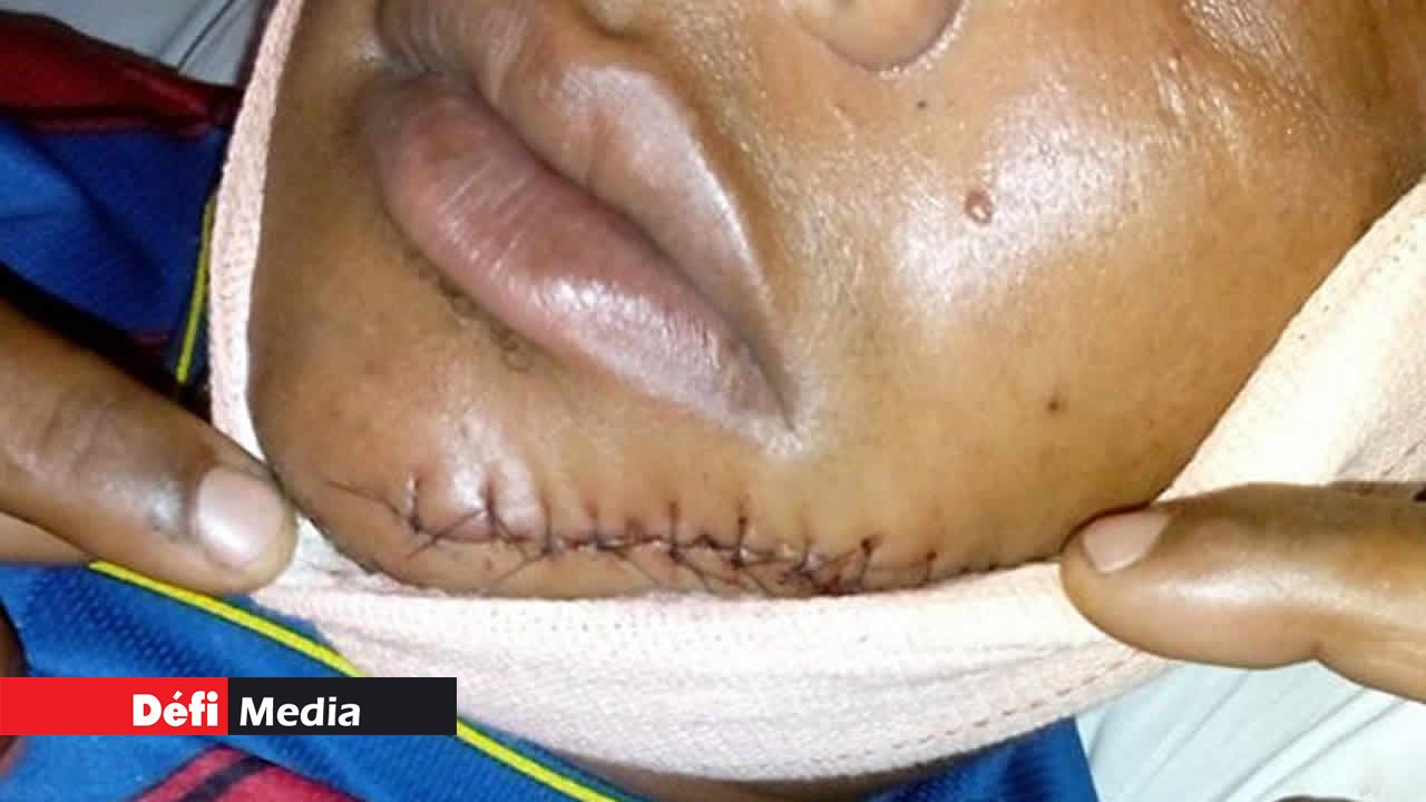 L’agresseur de Patrick H. le regardait fixement
avant de s’en prendre à lui.